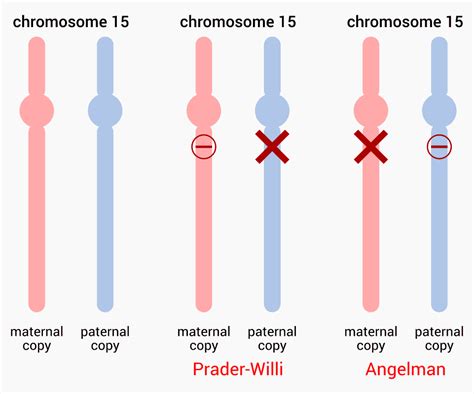 prader willi dna region replication time|paternal deletion prader willi syndrome.